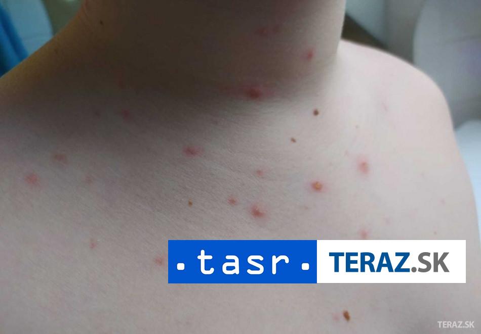 Na osypy v Bangladesi zomrelo takmer 500 deti